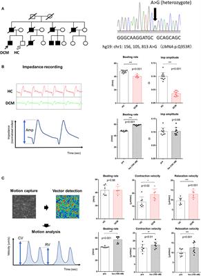 Trends and Limitations in the Assessment of the Contractile Properties of Human Induced Pluripotent Stem Cell-Derived Cardiomyocytes From Patients With Dilated Cardiomyopathy